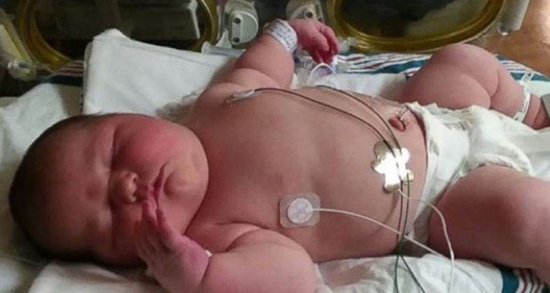 Mujer da a luz a una bebé gigante de 6 kilos; hasta los médicos se  sorprendieron