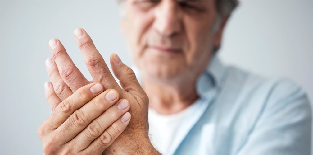 Los mitos y verdades de la artritis