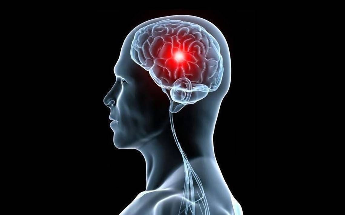 Cuídate del infarto cerebral
