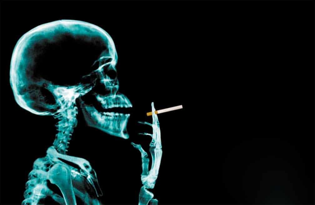 En 2020 el tabaquismo será la primera causa de muerte en el mundo