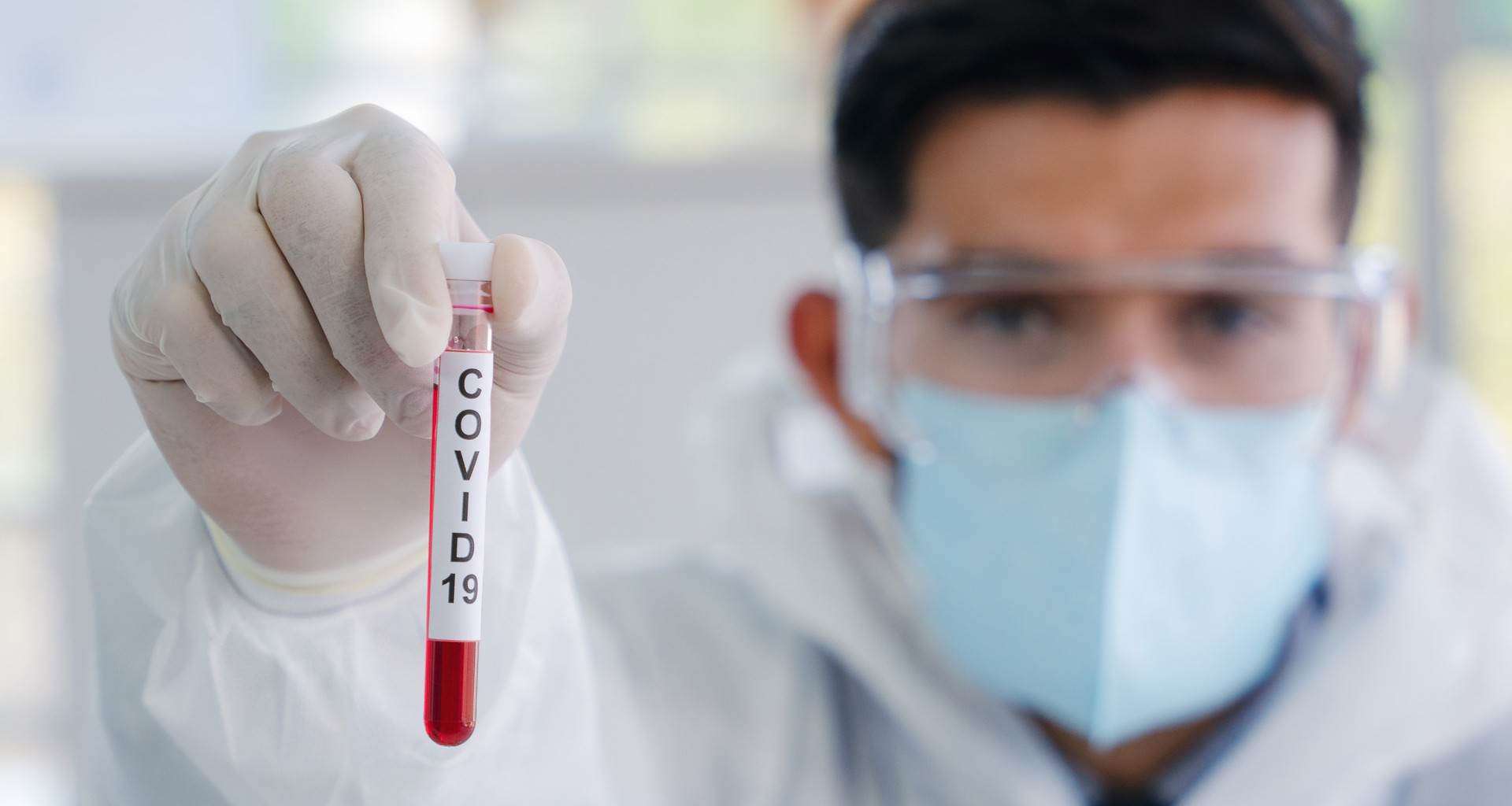 Letalidad de Covid-19 es 'más baja': estudio de la Universidad de Stanford