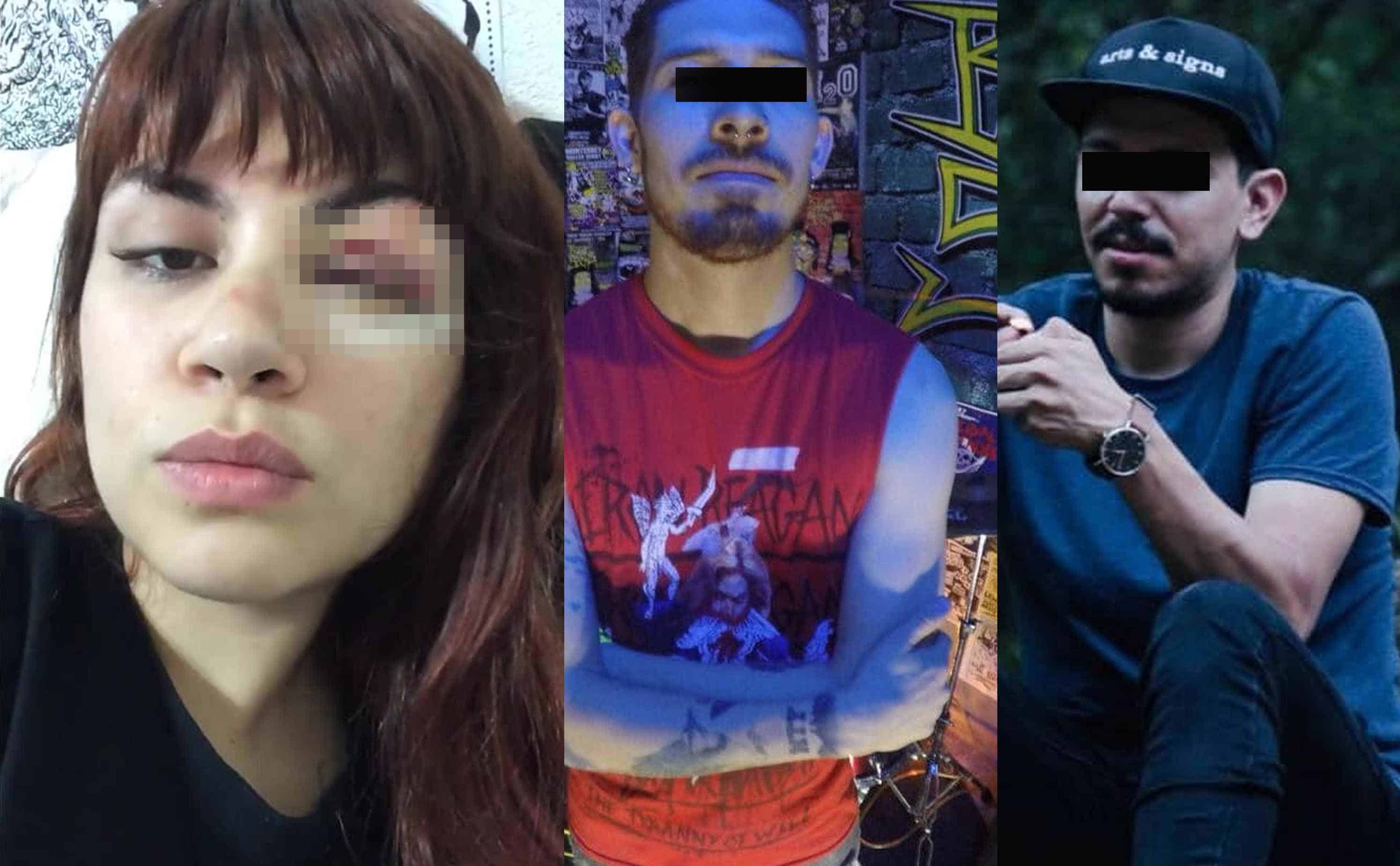 Joven exige justicia para quienes provocaron que perdiera un ojo