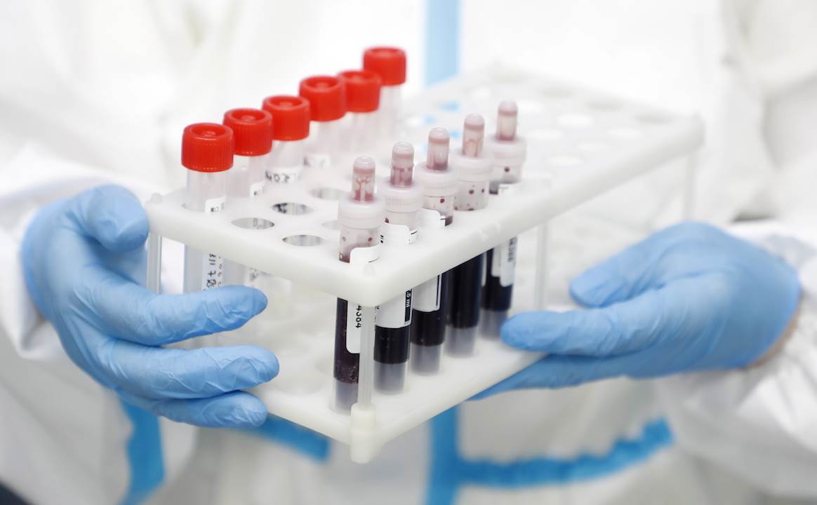 Estados Unidos y Pfizer pactan para compra de vacunas contra el COVID-19