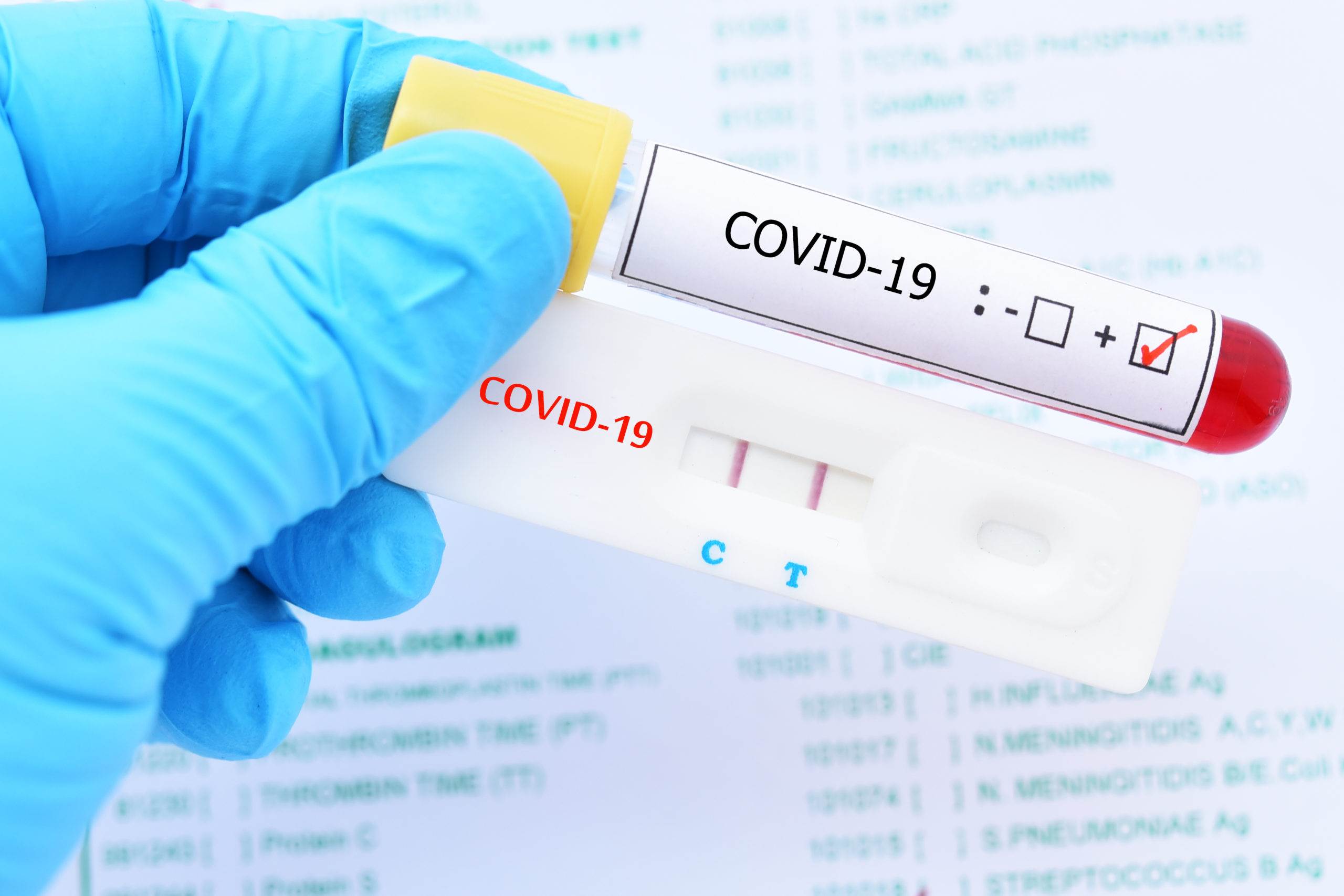 Autorizan test de COVID con saliva en EUA probado en jugadores de la NBA
